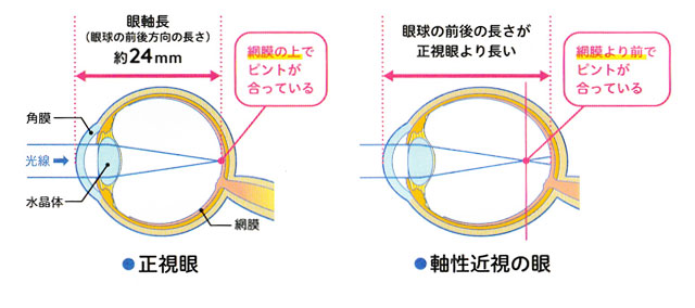 �ߎ��̐����}